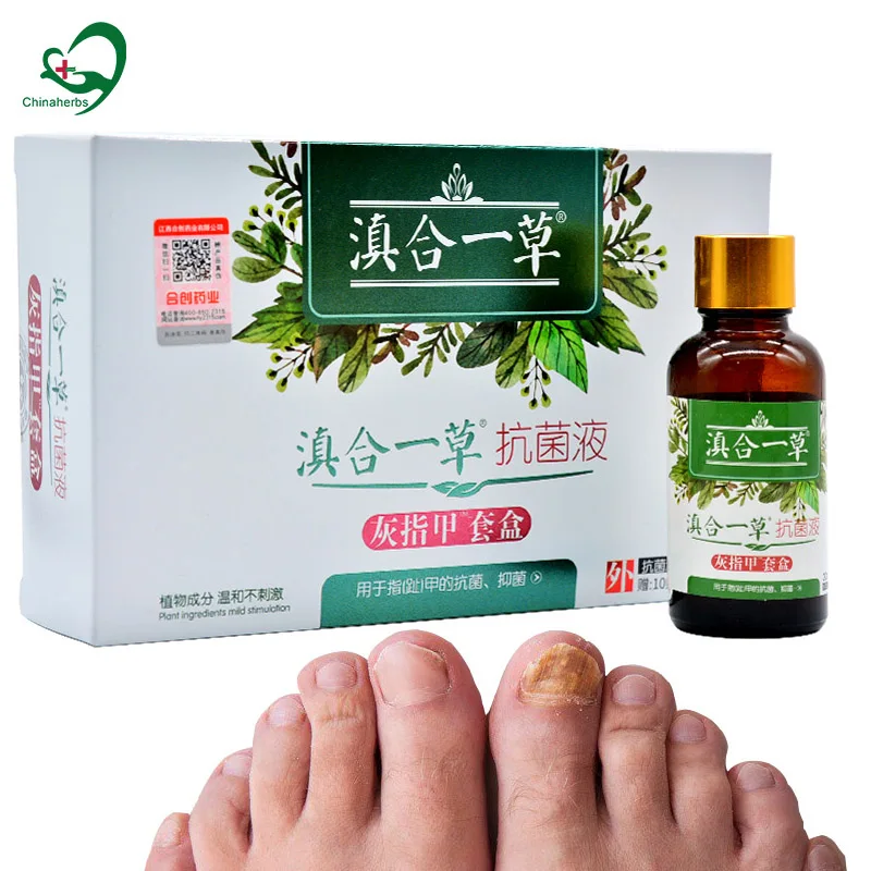 

2 Packs Nail Fungal Treatment Foot Fingernail Paronychia Onychomycosis Fungus Removal Serum Gel Anti Infection Feet Care Essence