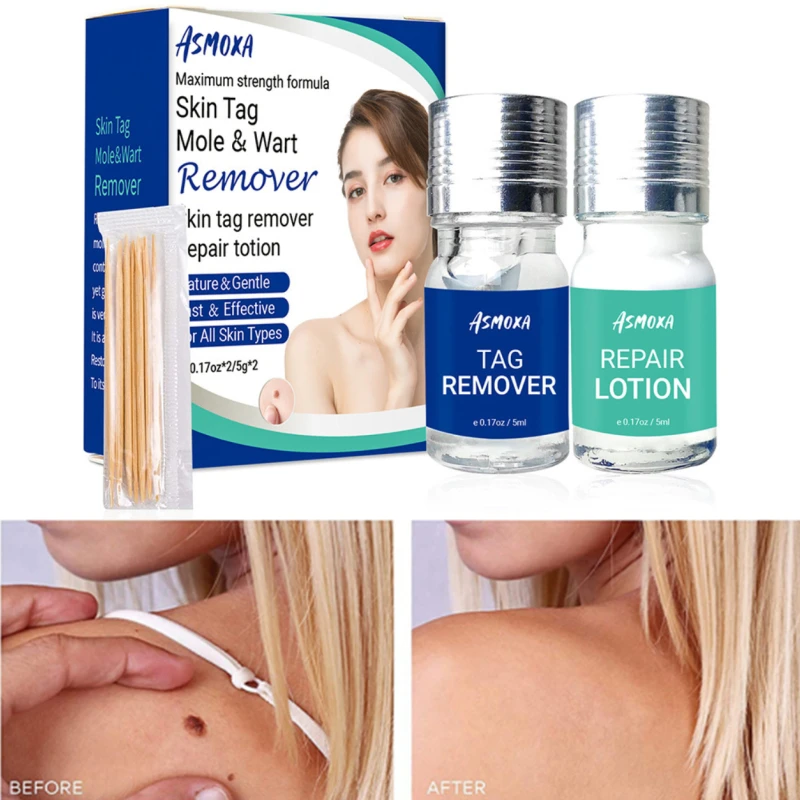 

Органическая Сыворотка для удаления бородавок, безболезненный корректор бородавок, средство для ухода за кожей, косметическая сыворотка