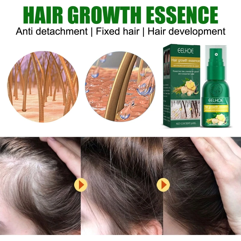 

Hair Growth Essence Hair Loss Treatment Fluid Hair Growth Natural Ginger Essence Spray Repair Damaged Hair Care 30ml 2022 New