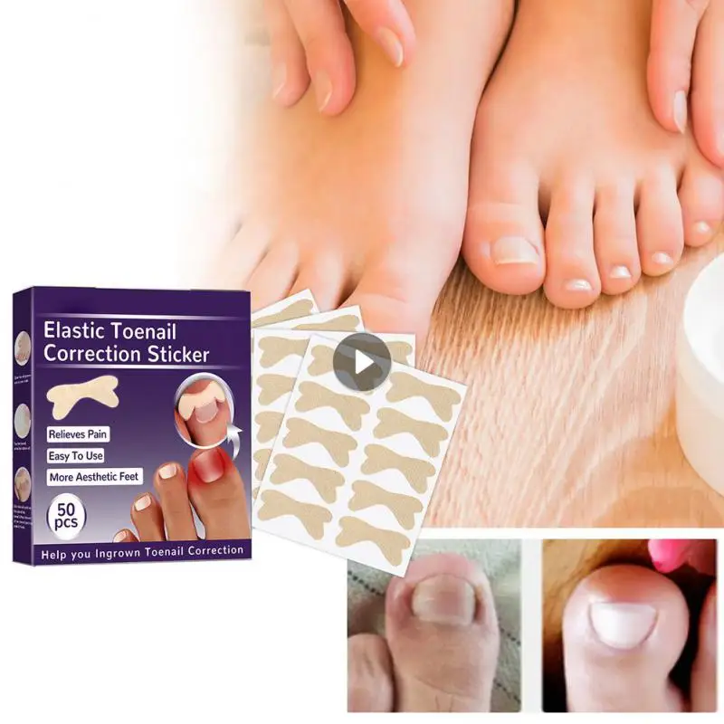 

Коррекция желоба ногтей ремонт поврежденных ногтей Пряжка для ногтей правильное невыровненное обслуживание ногтей среднее качество Уход за ногтями