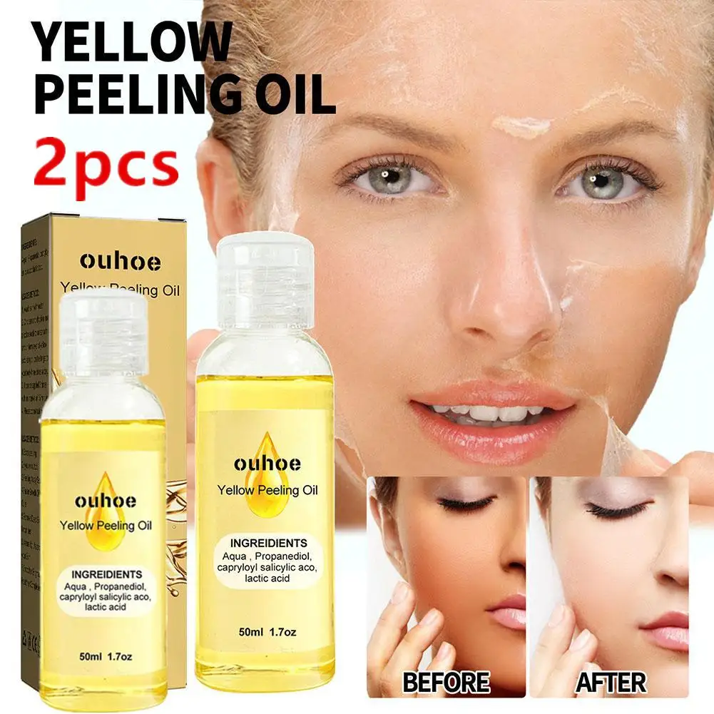 

2X50 мл натуральные пятна Отбеливание желтое пилинг масло темные пятна акне меланин отбеливание кожи отшелушивающее масло