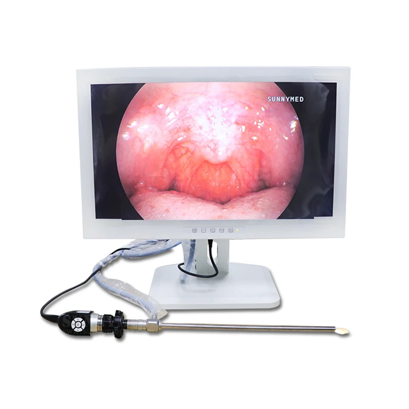 

SY-PS047 Rigid Endoscope with LED Light Source Integrated Endoscopy Camera