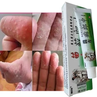 herbal antibacterial cream psoriasis cream anti itch relief eczema skin rash urticaria desquamation treatment xlz