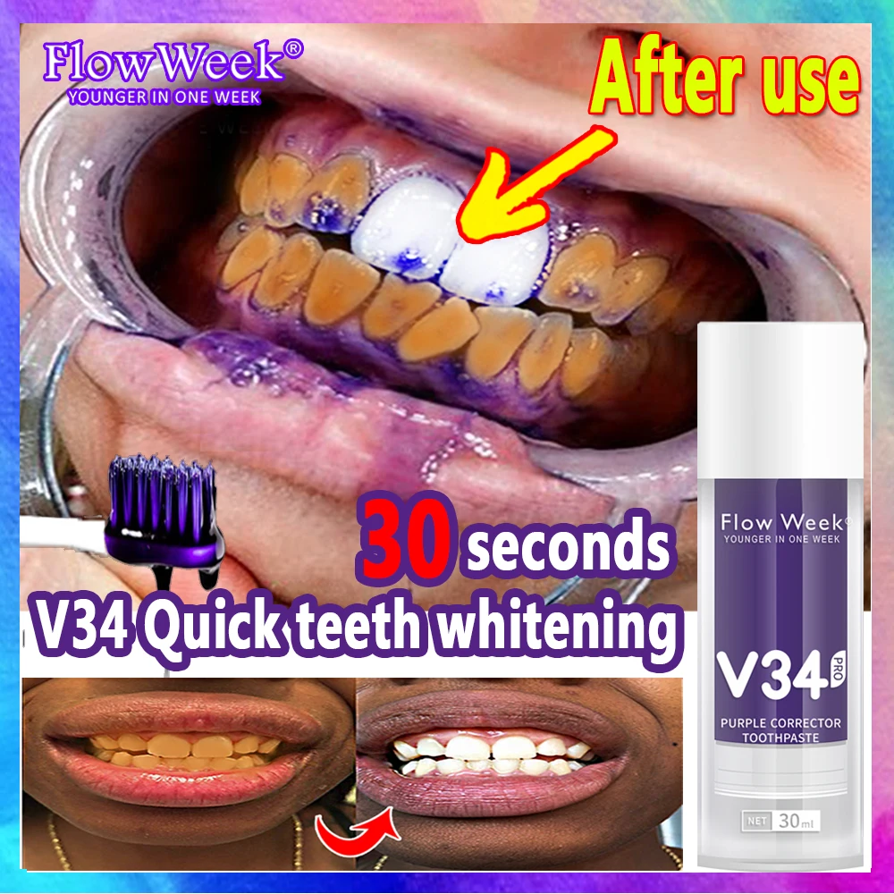 

Фиолетовая зубная паста FlowWeek V34, отбеливание зубов V34, белые зубы, белая зубная паста, отбеливающие зубы, удаление сигаретных пятен от кофе