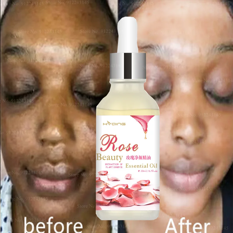 

Whitening To Dark Spots Rose Clean Face Brightening Essential Oil Facial Care Massage Compound Essential Oil for Men and Women