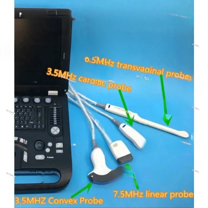 Высококачественное 3D-ультразвуковое медицинское сканирование цифровое