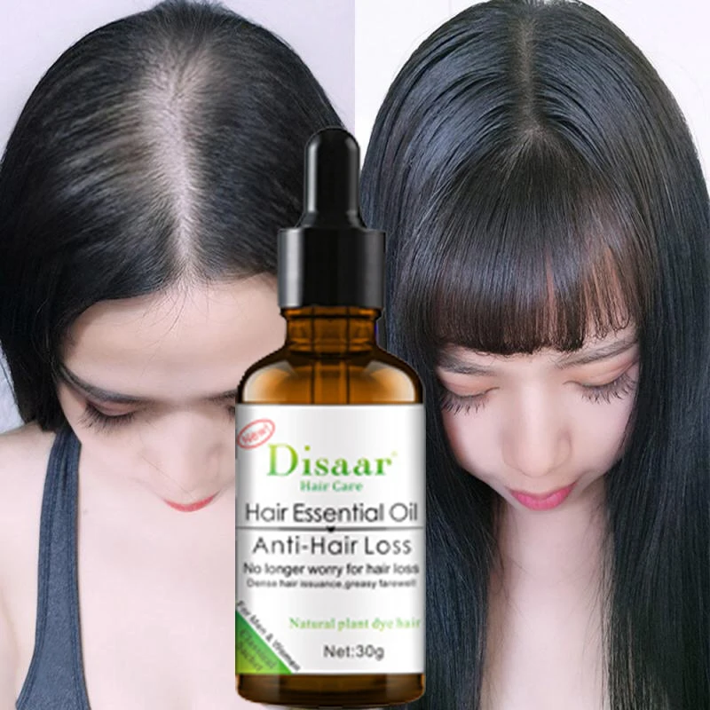 Natural Biotin Fast Hair Growth Oil Regrowth Serum Liquid Product Thinning Treatment Anti Loss Thicken Nourish Scalp Care Beauty