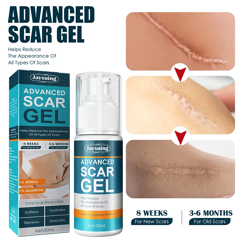 

50ML Fast Remove Scar Removal Cream Scaraway Advanced Scar Gel Old Scars Stretch Marks Burn Scars Tummy Tuck