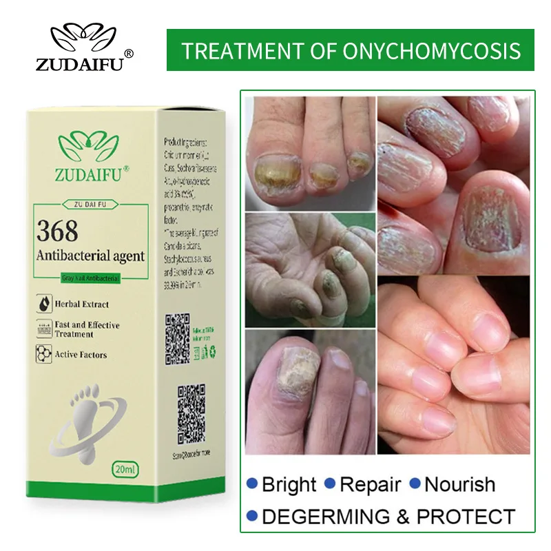 Сыворотка для лечения Ногтей от грибка ZUDAIFU средство ухода за ногами грибков