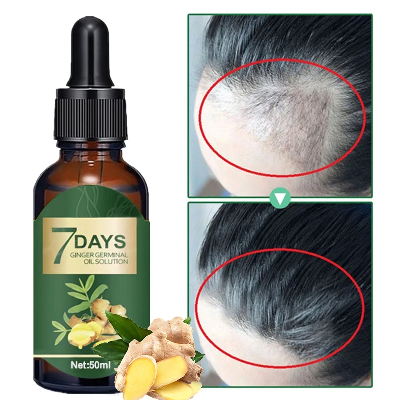 

7-day Ginger Hair Growth Essential Oil Nourishes Hair Follicles, Prevents Hair Loss, Soothes Scalp and Promotes Hair Growth