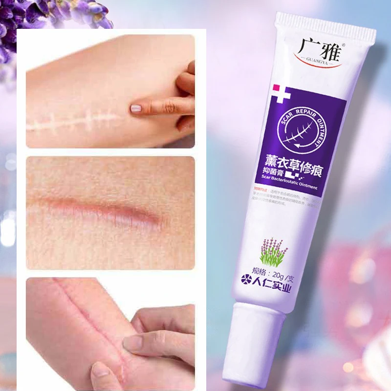 

Scar Removal Cream Gel Remove Acne Spots Stretch Marks Burn Surgical Scar Repair ointment for face body Whitening Skin Care