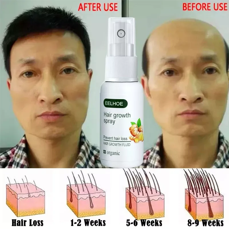 

NEW IN Fast Hair Growth Spray Serum Ginger Anti Hair Loss Treatment Product Prevent Thinning Dry Frizzy Repair Beauty Hair Care