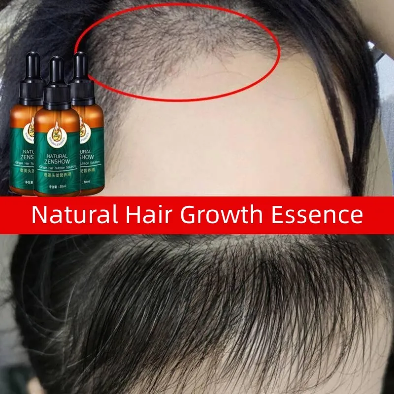 

Hair Growth Products Ginger Anti Hair Loss Essential Oil Treatment Hair Thinning Dry Frizzy Damaged Repair Essence For Men Women