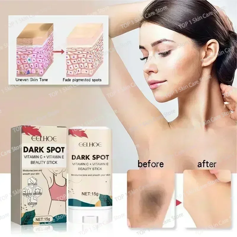 Горячие продажи отбеливающий крем для удаления темных пятен и корректора нежный