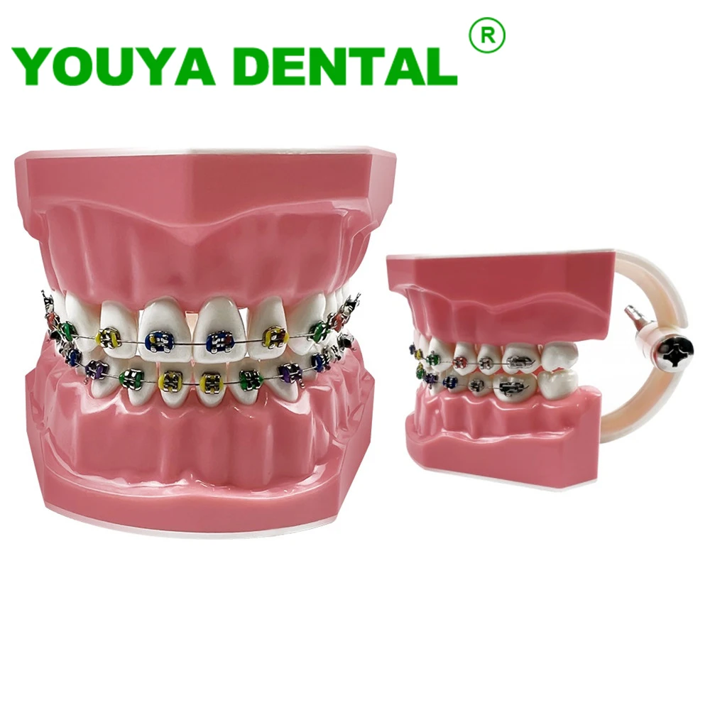 

Dental Typodont Orthodontic Teeth Model Dentistry Education Demonstration Tools With Metal Bracket Braces Arch Wire Ligature Tie