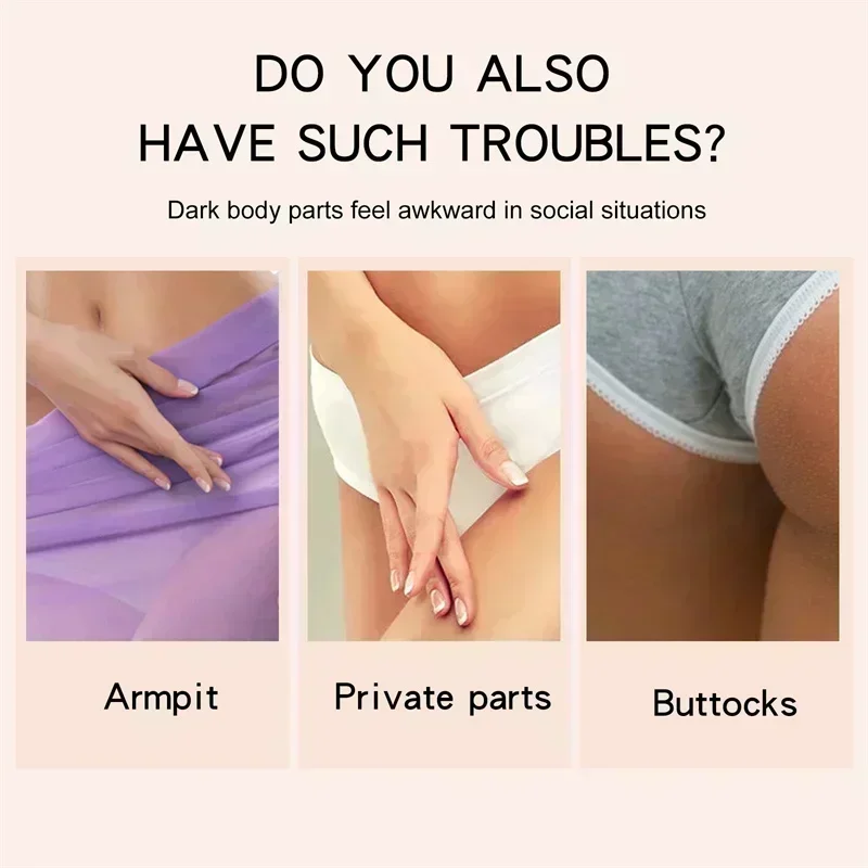 ГОРЯЧИЙ ~ отбеливающий крем отбеливающая сыворотка для интимных частей подмышек