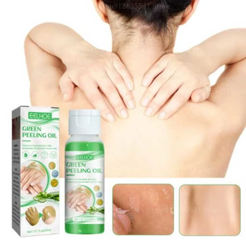 

30ML Strong Whitening Peeling Oil Aloe Vera Glycerin Remove Dead Skin Exfoliating Moisturize Body Skin Brighten Skin Oil