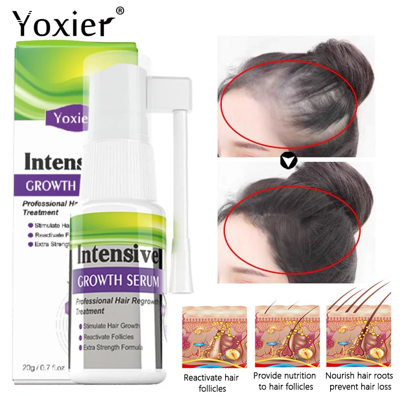 

Intensive Hair Growth Serum Spray Promote Regrowth Repair Damaged Prevent Baldness Treatment Ginger Germinal Liquid Scalp Care