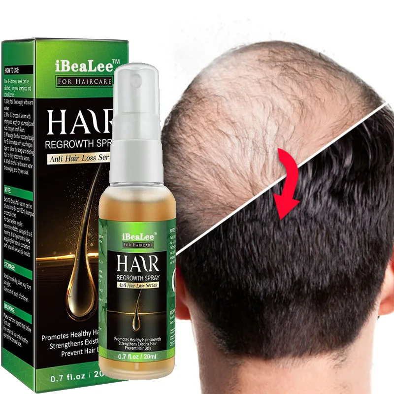 

Ginger Hair Growth Products Natural Essence Anti Hair Loss Prevent Baldness Treatment Fast Growing Nourish Dry Damaged Hair Care