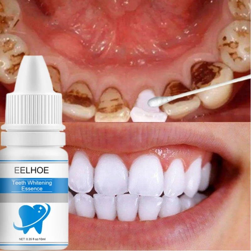 Teeth Whitening Essence Remove Plaque Stains Oral Hygiene Serum Products Bleaching Cleaning Dental Fresh Breath Beauty Care Tool
