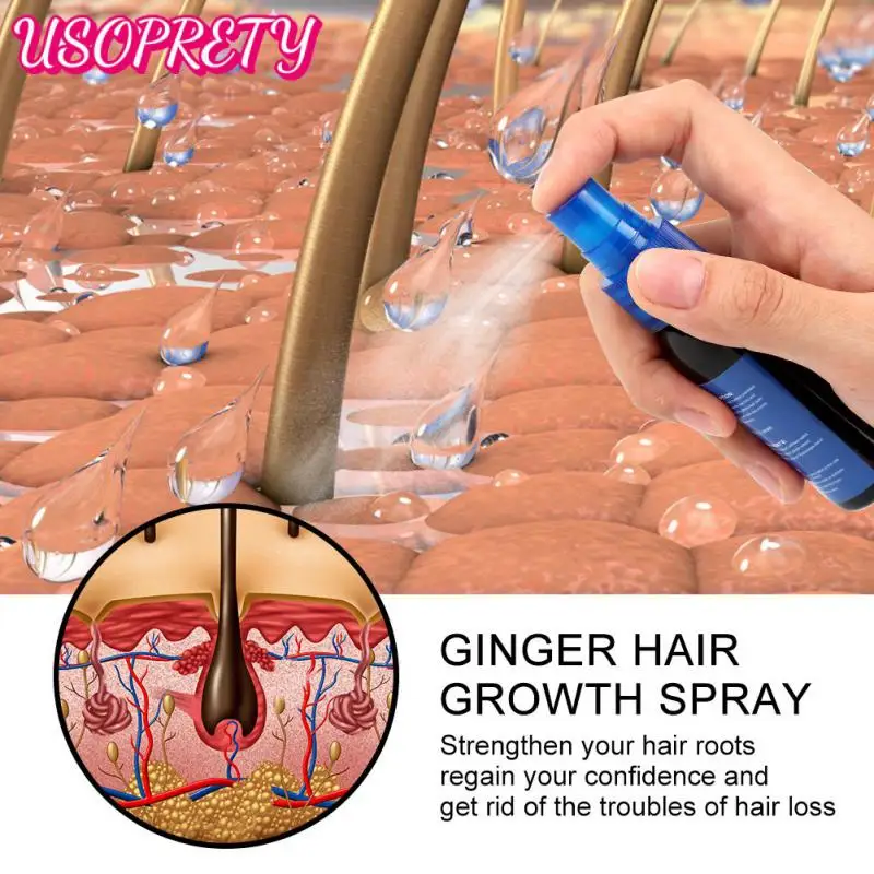 

30ml Ginger Hair Spray/100ml Shampoo Antipruritic Anti-dandruff Oil Control Refreshing Prevent Hair Loss Growth Care Nutrient