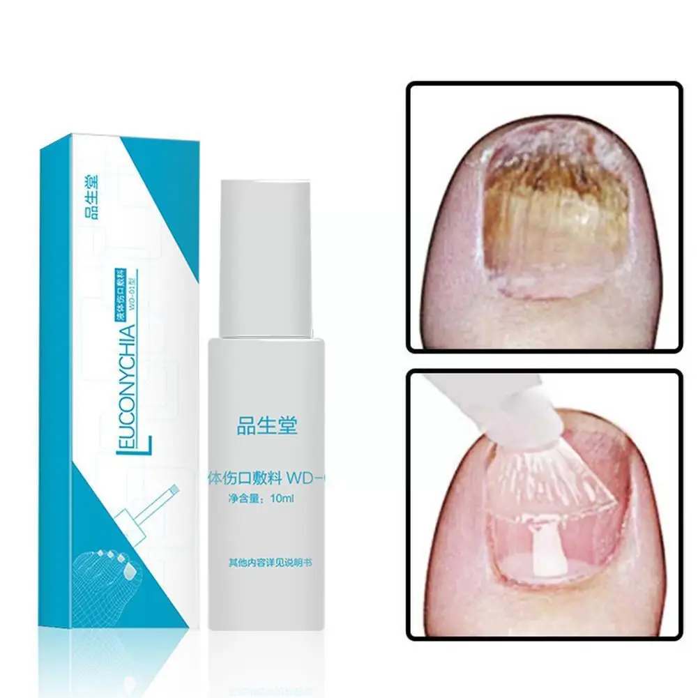 

Nail Care Solution Feet And Hand Gray Nails Anti-bacterial Oil Fungal Treatment Disinfection Tools Pen Manicure Repa P0y4