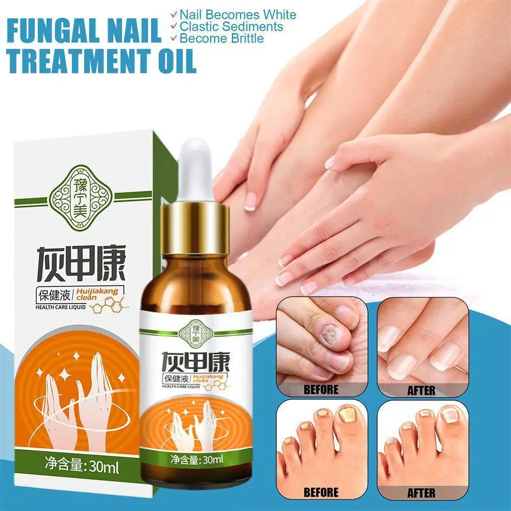 

Nail Treatment Essence Serum Toenail Fungus Repair Foot Anti Infection Fungal Oil For Hand And Foot Care 30ml D5K0