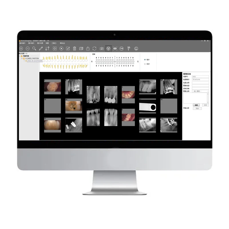 

CMOS Tech Images High Efficiency Dental Digital Intraoral Xray Sensor