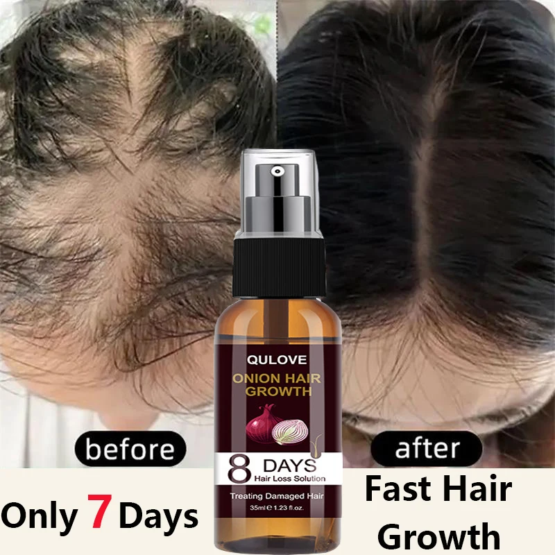 

Herbal Hair Growth Serum Spray Fast Regrowth Anti Hair Loss Essences Prevent Baldness Nourish Damaged Scalp Treatment Hair Care