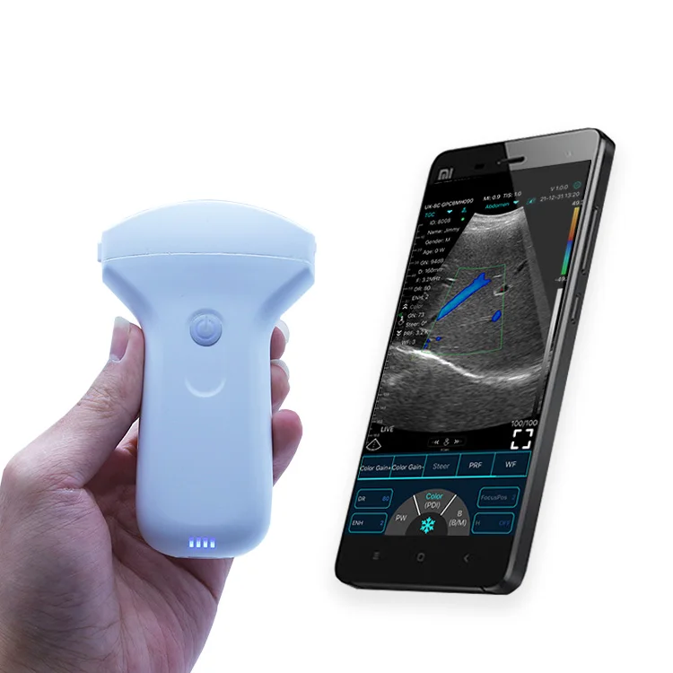 

Высококачественный портативный допплеровский ультразвуковой мини беспроводной портативный ручной ультразвуковой зонд Usb Wi-Fi ультразвуковой зонд