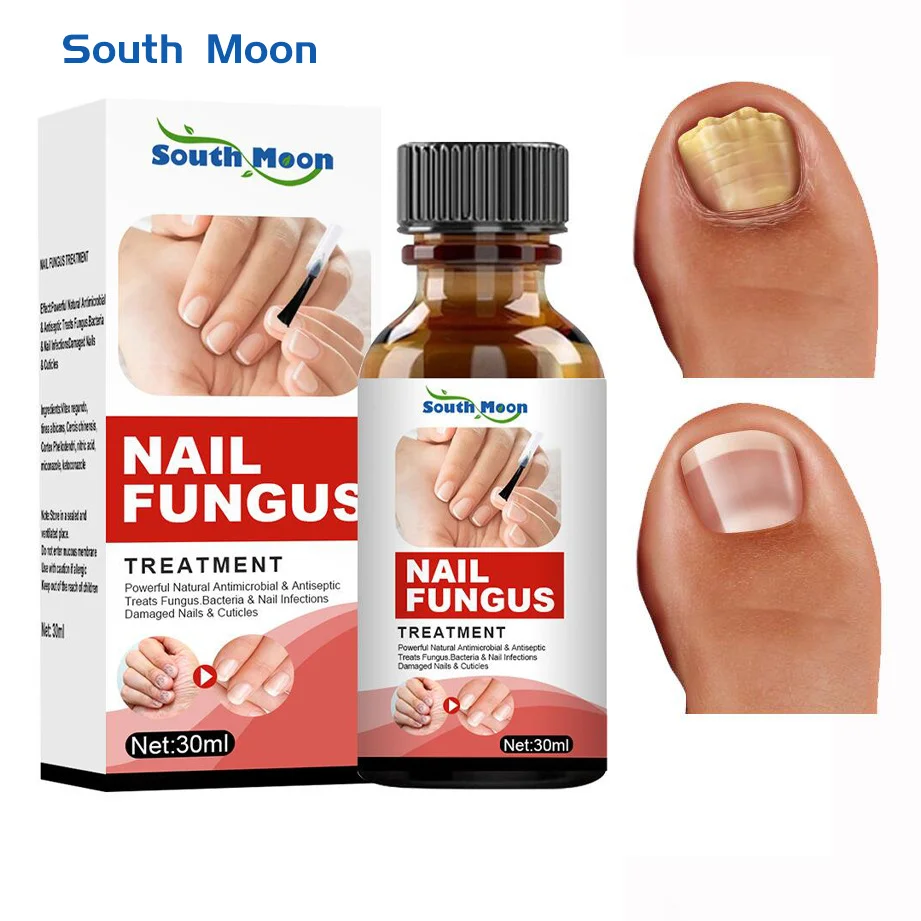 

Nail Fungus Treatment Serum Herbal Anti Infection Remove Toe Nail Paronychia Onychomycosis Reapir Damaged Essence Foot Care 30ml