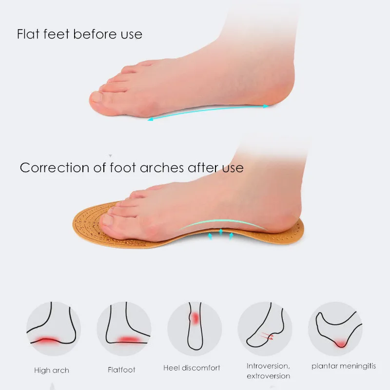 Leather Arch Insoles Flat Foot Arch Support Orthopedic Insoles Shoes Foot Varus Valgus  X-O Leg Corrector Shock-absorbing Insole