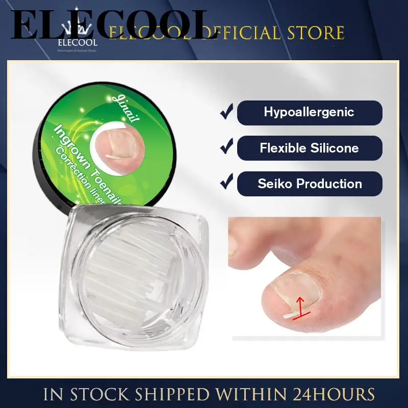 

Ортопедические подушки эффективные инструменты для ухода за ступнями, прочные вставки для устранения вросших ногтей, безопасные корректирующие вросшие ногти