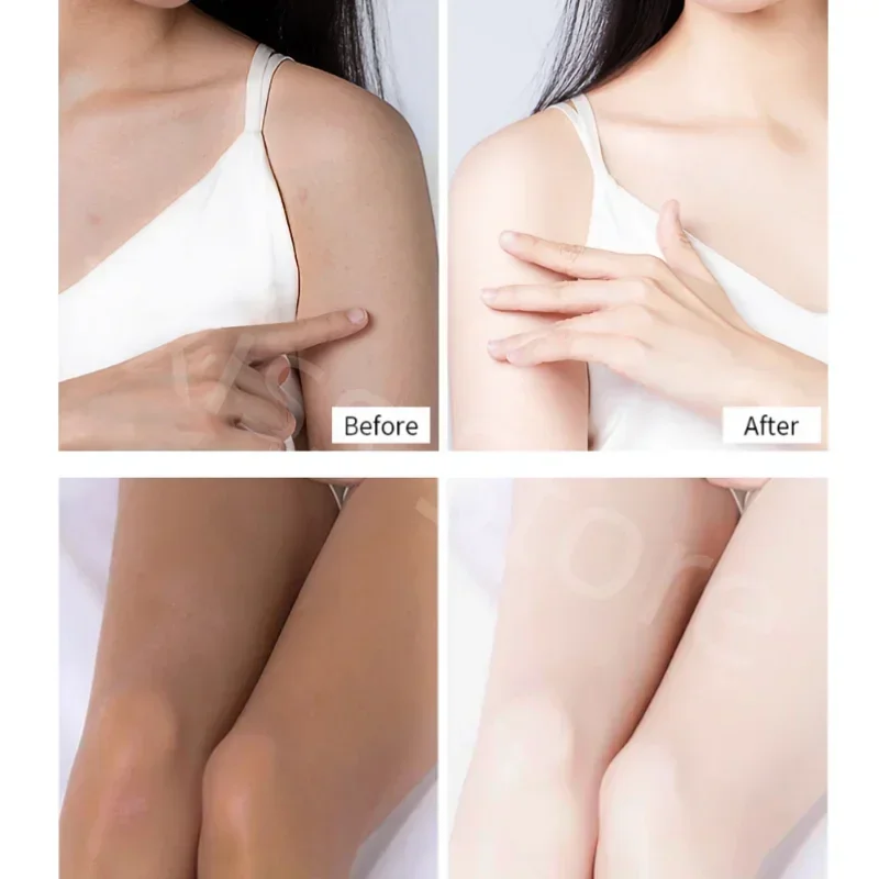 400 мл лосьон для тела с вазелином увлажняющее средство удаления куриной кожи