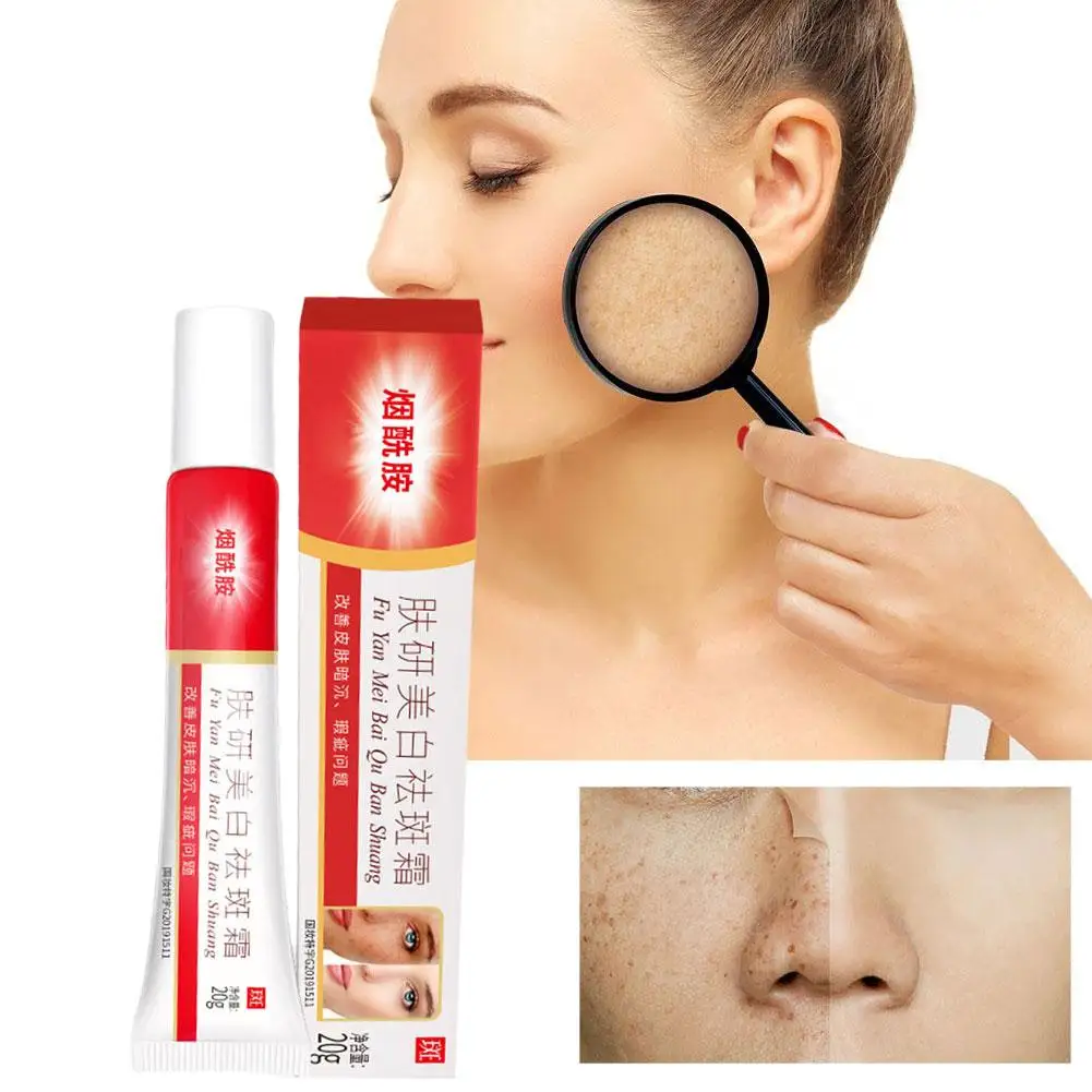 

Effective Whitening Freckle Cream Remove Dark Spots Skin Freckle Cream 20g Fade Pigmentation Brighten Care Melasma Creams A B5E4