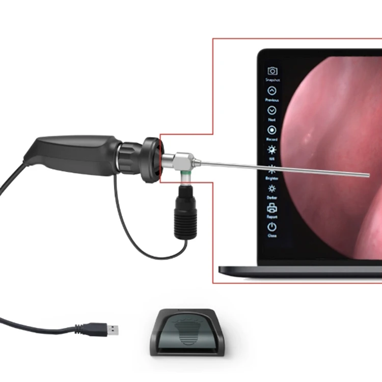 2K Portable Video Medical Clinical Surgery ENT Anorectal Mirror Veterinary Endoscope Camera