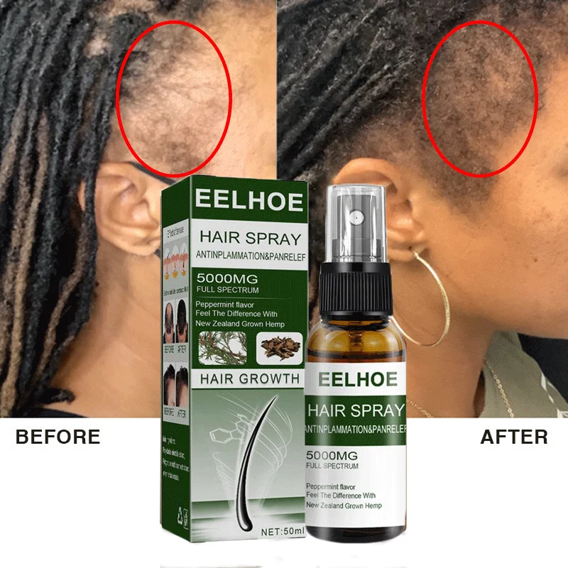 

Fast Hair Growth Essence Spray Ginger Prevent Hair Loss Treatment Products Nourishing Scalp Repair Damaged Hair Care Men Women
