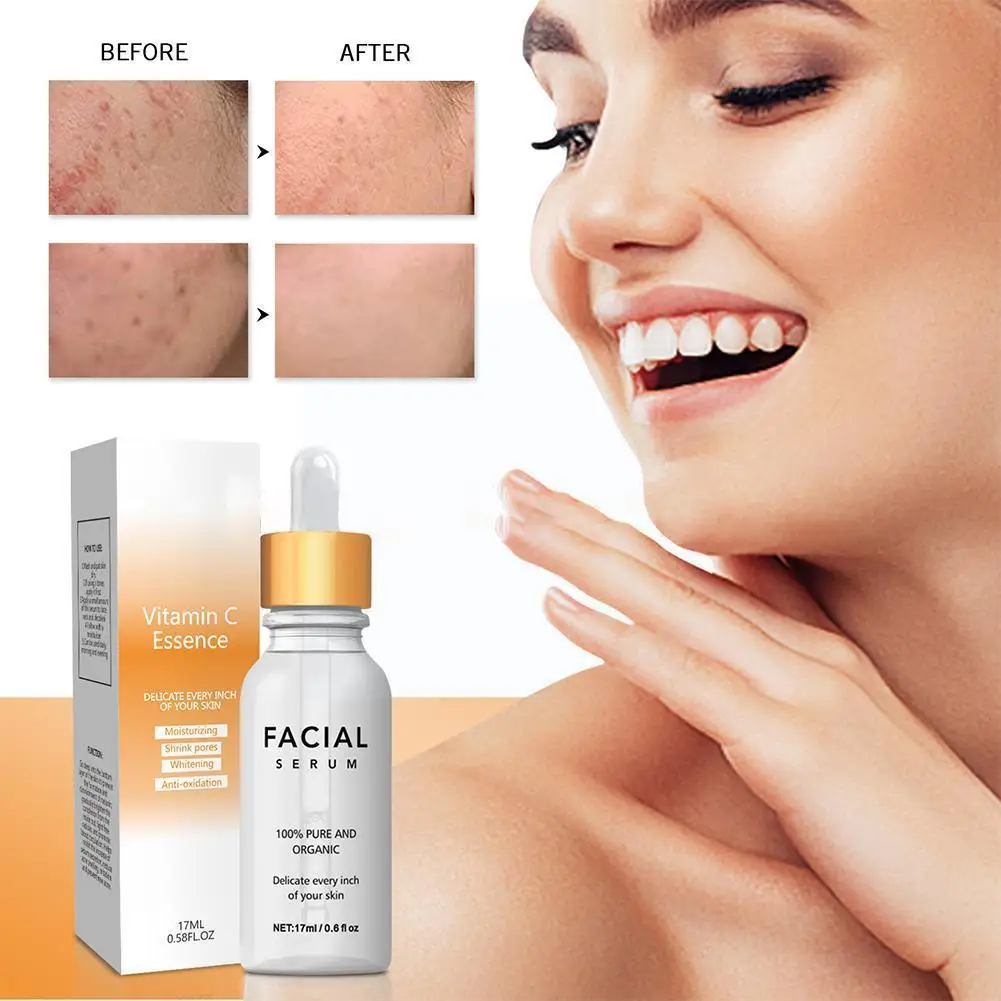 

17ml Hyaluronic Acid Serum Whitening Niacinamide Serum Serum Brighten Remover Blemish Vc Face Essence Freckle Moisturizing Q2p3