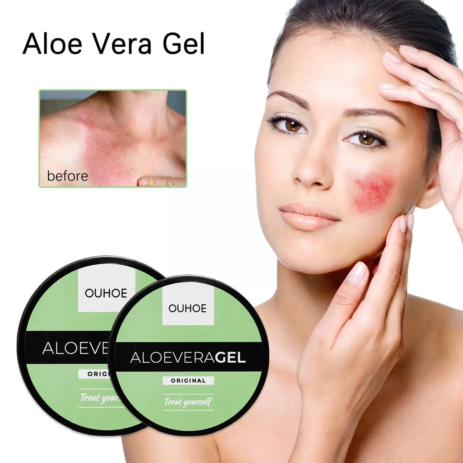 

Aloe Vera Gel Skin Care Supplementary Nutrition Moisturizing Fine Whitening Skin Acne Beauty Pores The Dilute After Rep W3k0