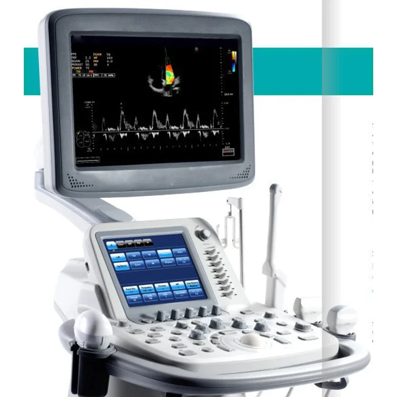 Портативный ультразвуковой аппарат Color Doppler Sonoscape S2 портативный