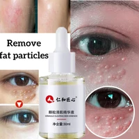 granular clear muscle essence to remove acne marks acne fat particles blackheads herbal repair essence skin care