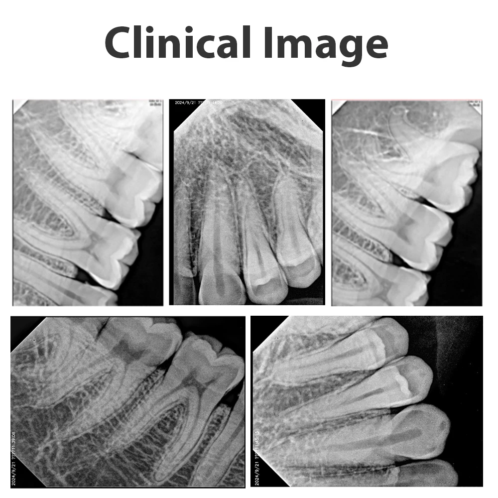 Фото EYY Dental Oral Sensor Система рентгеновской визуализации Rx Radiovisografo Стоматологическое цифровое внутриротовое сенсорное оборудование Кабель длиной 3 м с программным обеспечением №4