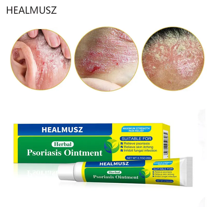 

Herbal Antibacterial Cream Anti-itch Ointment Treatment Relief Psoriasis Eczema Skin Rash Urticaria Desquamation Body Care 20g
