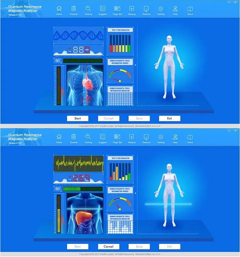 2024 квантовый физический детектор тела/магнитно-резонансный анализатор