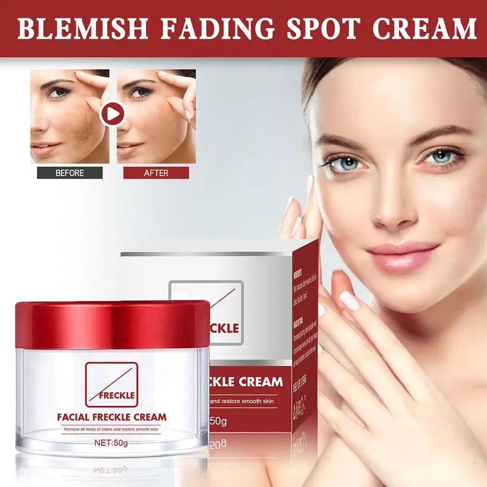 

50g Powerful Whitening Freckle Cream Remove Acne Spots Skin Melanin Moisturizing Face Face Spots Cream Care Dark Brighten K6G0