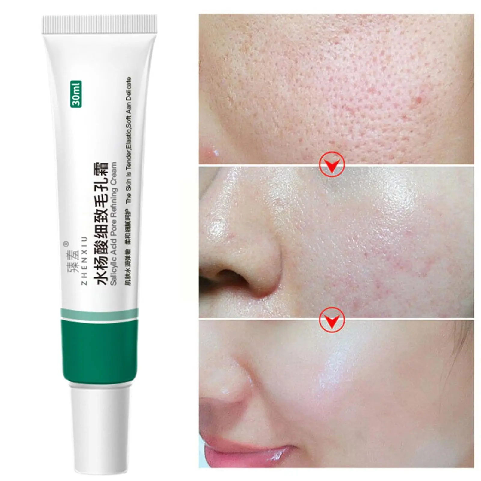 

Салициловая кислота, усадка пор, крем, гель, увлажняющий, для удаления черных точек, крем, контроль жирности, очищение пор, ремонт, мягкий ухо...