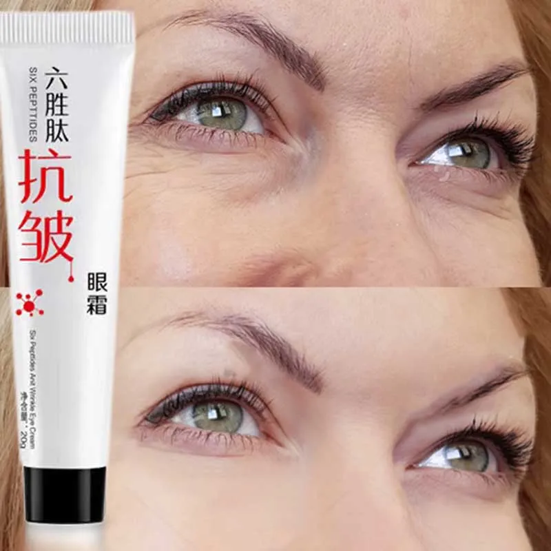 

Увлажняющий крем для области вокруг глаз, от Тёмных кругов, морщин, жира, мешков и припухлости