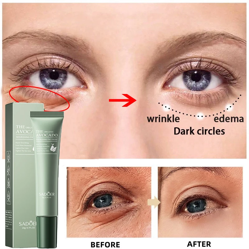 Anti Dark Circle Eye Cream Avocado Anti-Wrinkle Fade Fine Lines Firming Lifting Remove Eye Bag Anti Puffiness Eye Skin Care 20g