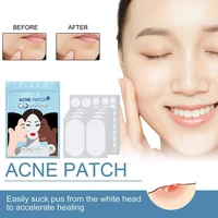80pcsset acne patches large size hydrocolloid acne invisible pimple master patch skin tag blackhead blemish removers skin care