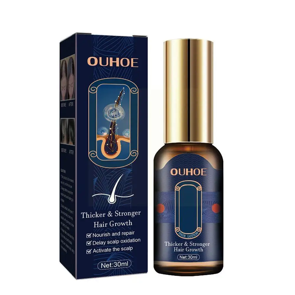 

Тоник для волос спрей для роста волос эфирное масло для лечения выпадения волос V3m8 Сыворотка для предотвращения выпадения волос Pro A2Q4